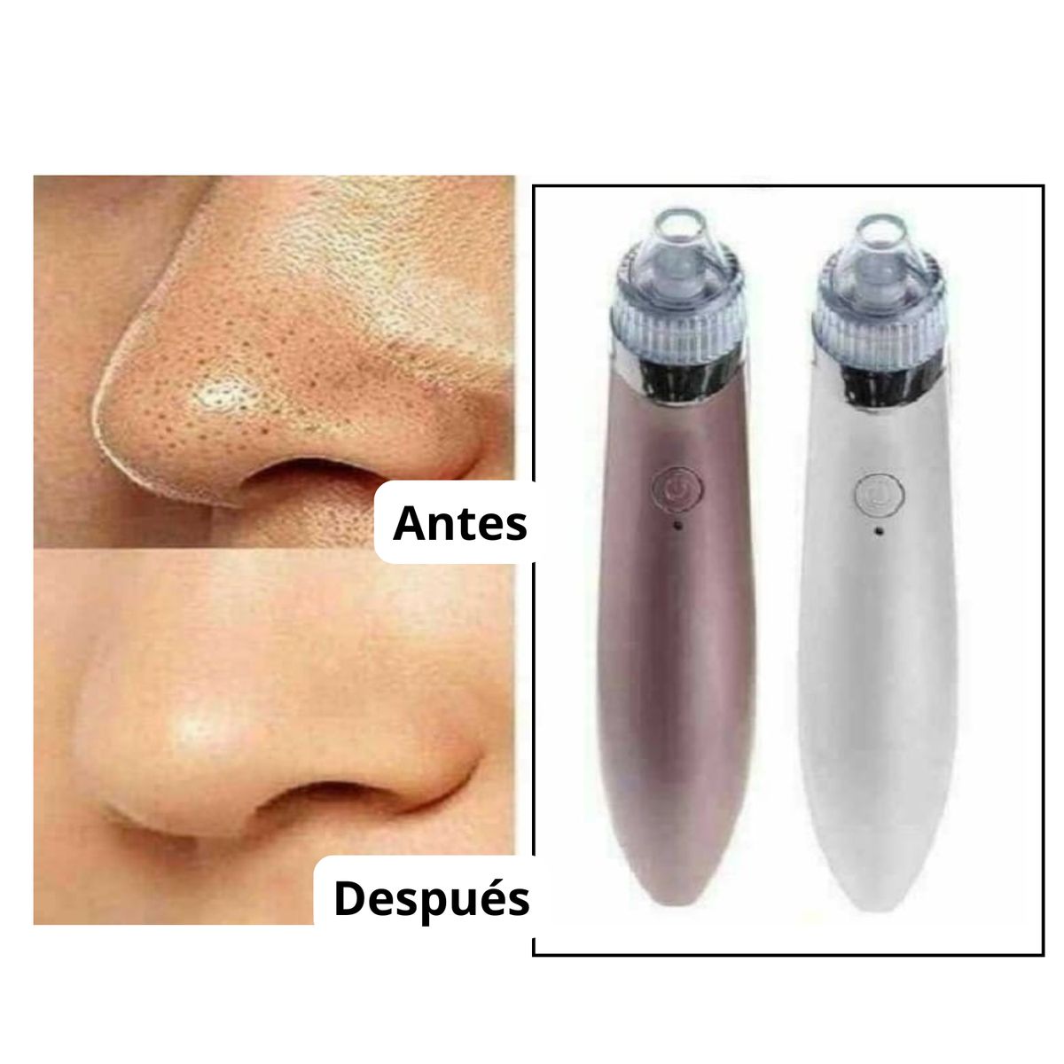 MOVI - Extractor y removedor de Puntos Negros