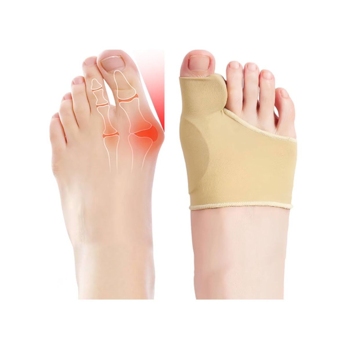 GENERICO - Pack x2 Corrector Ortopédico Juanete Dedo Del Pie Separador Agarre