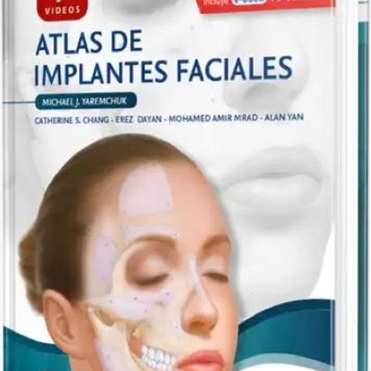 GENERICO - Libro Atlas de implantes faciales