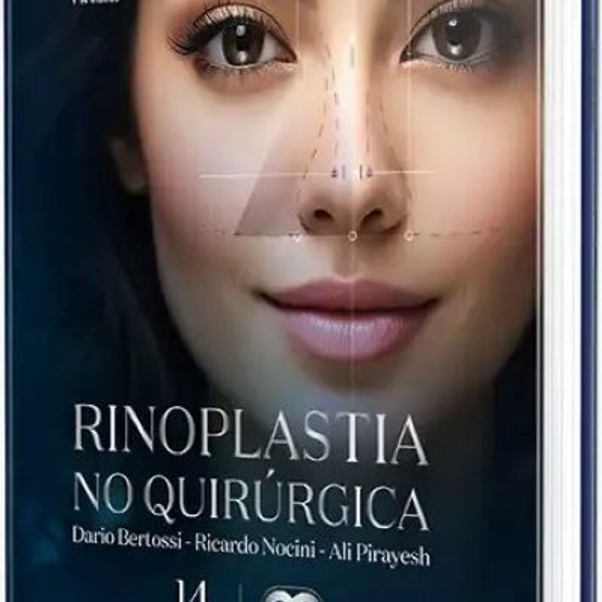 GENERICO - Libro Rinoplastia no quirúrgica