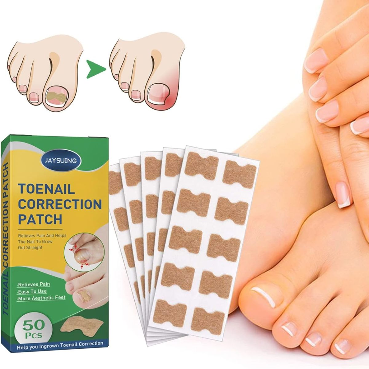 GENERICO - Pack 50 Parches Uñas Encarnadas Corrector De Crecimiento