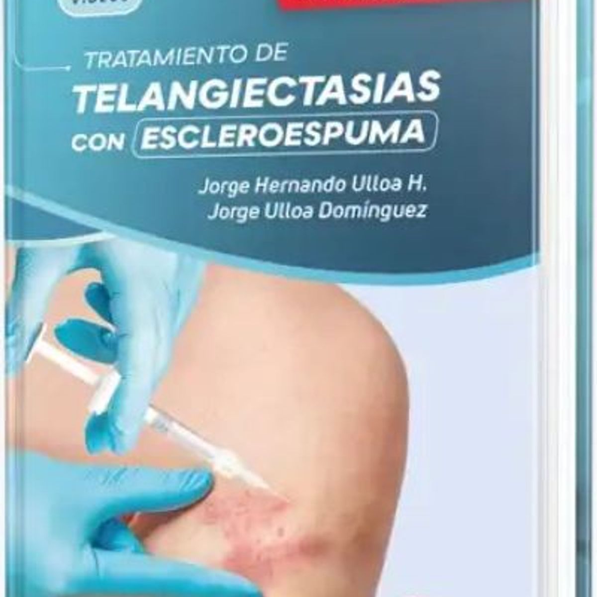 GENERICO - Libro Tratamiento de Telangiectasias con Escleroespuma