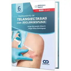 GENERICO - Libro Tratamiento de Telangiectasias con Escleroespuma