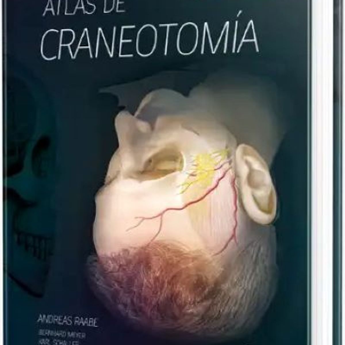 GENERICO - Libro Atlas de Craneotomía