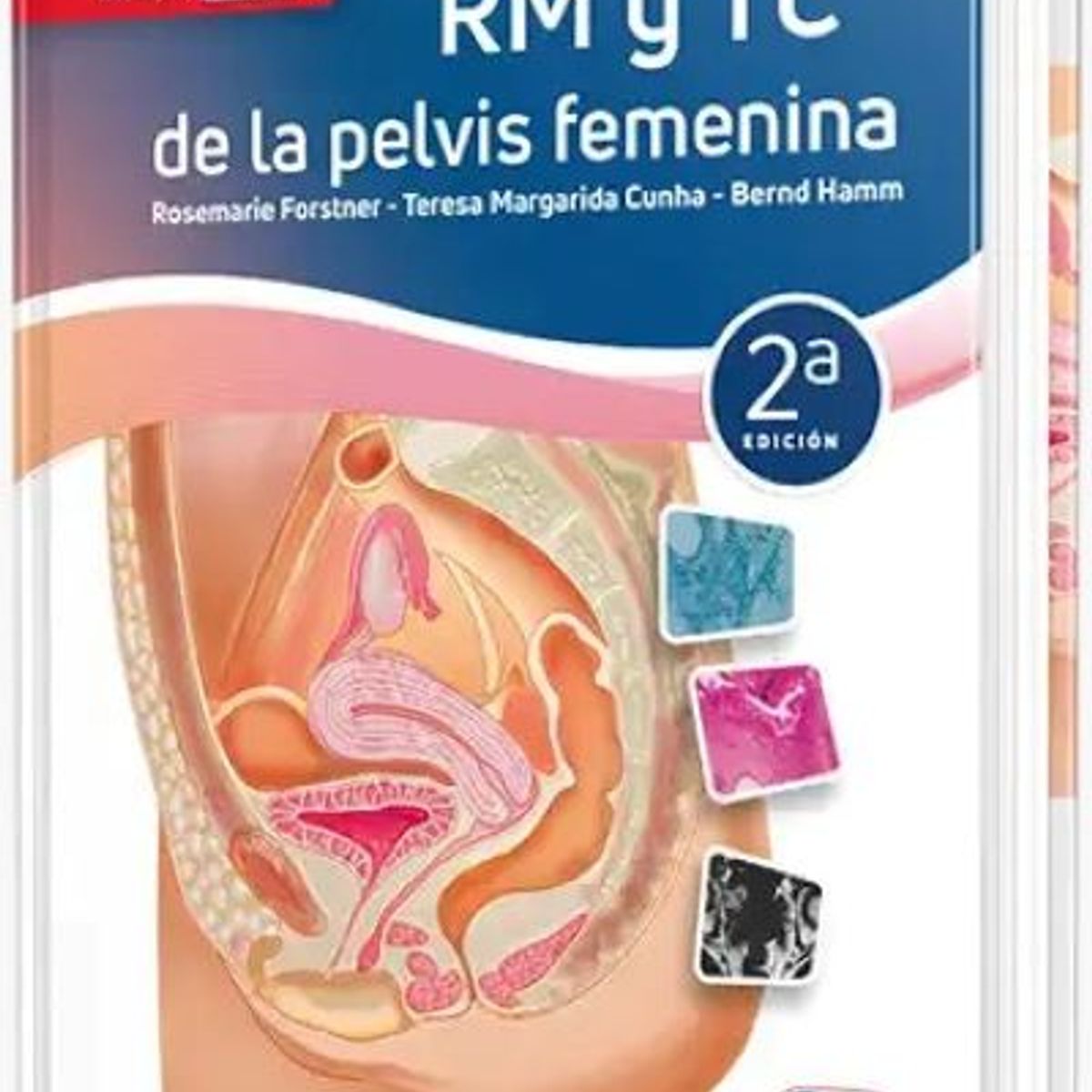 GENERICO - Libro RM y TC de la pelvis femenina 2a edición