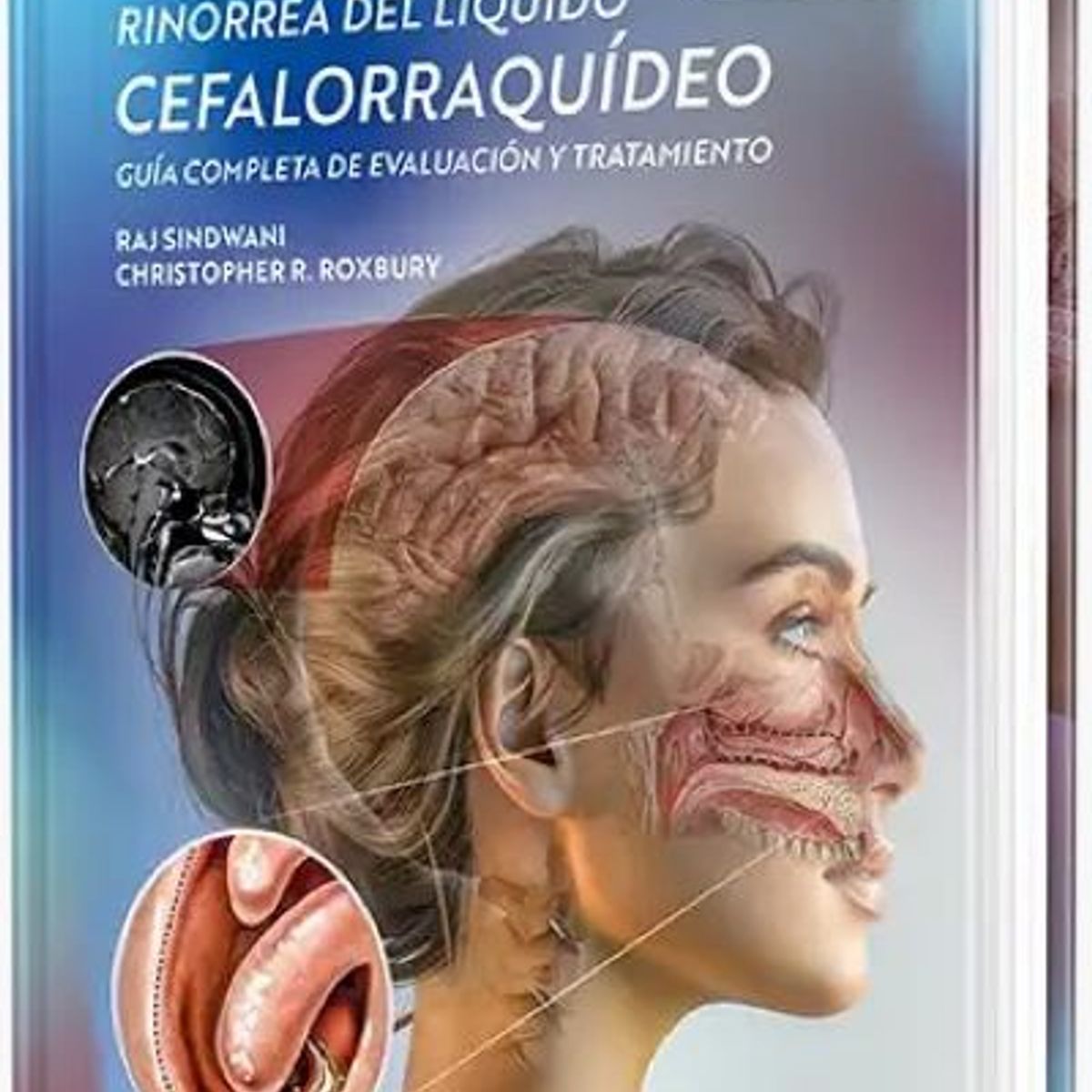 GENERICO - Libro Rinorrea del líquido cefalorraquídeo Guía completa de evaluación y tratamiento