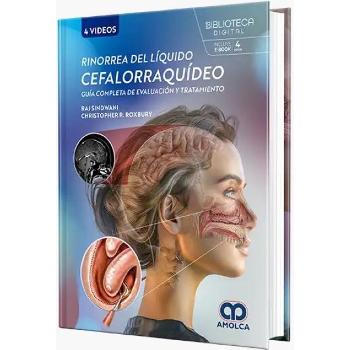 GENERICO - Libro Rinorrea del líquido cefalorraquídeo Guía completa de evaluación y tratamiento