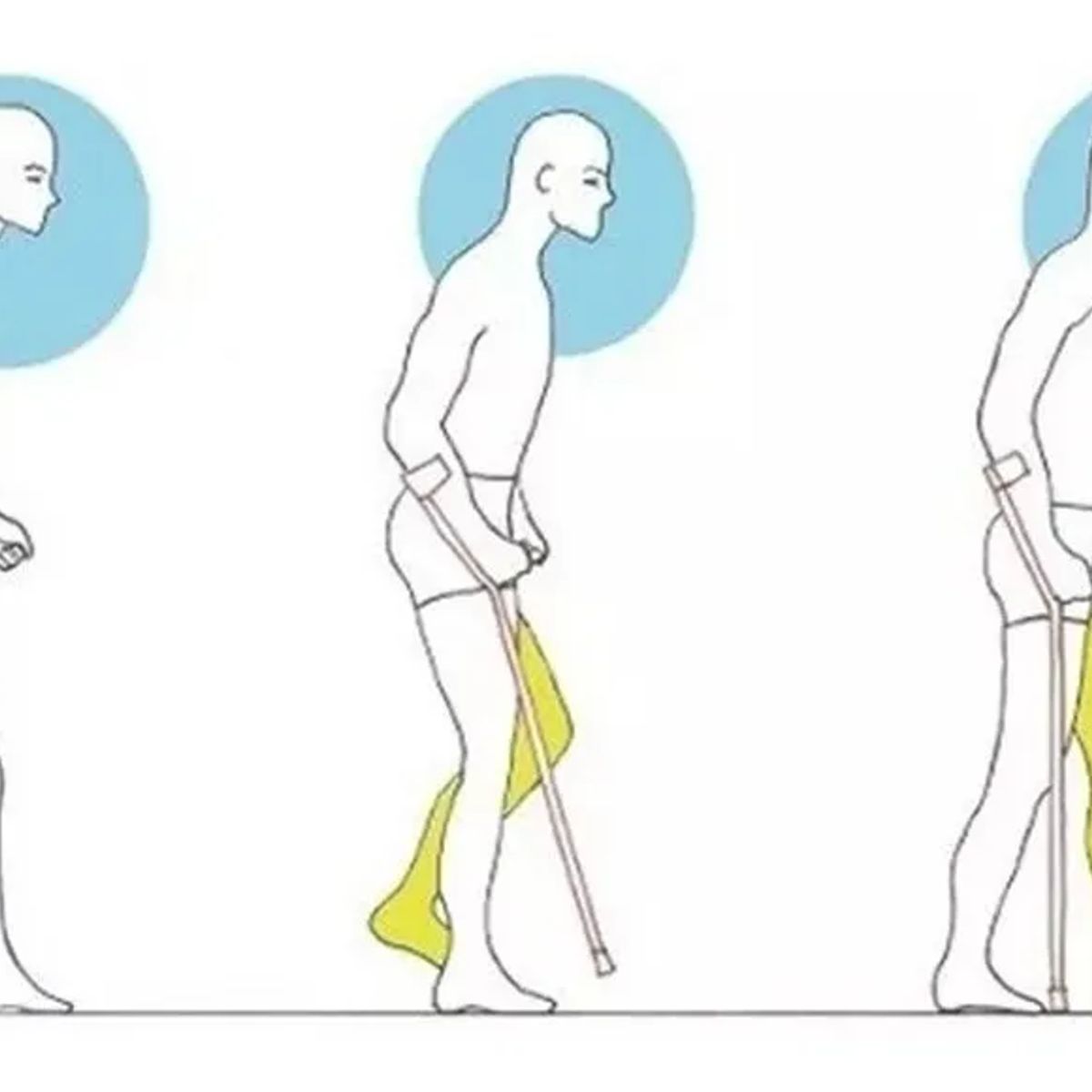 NO LOGO - 2 Bastón Muleta Canadiense Regulable En Altura Color Plateado