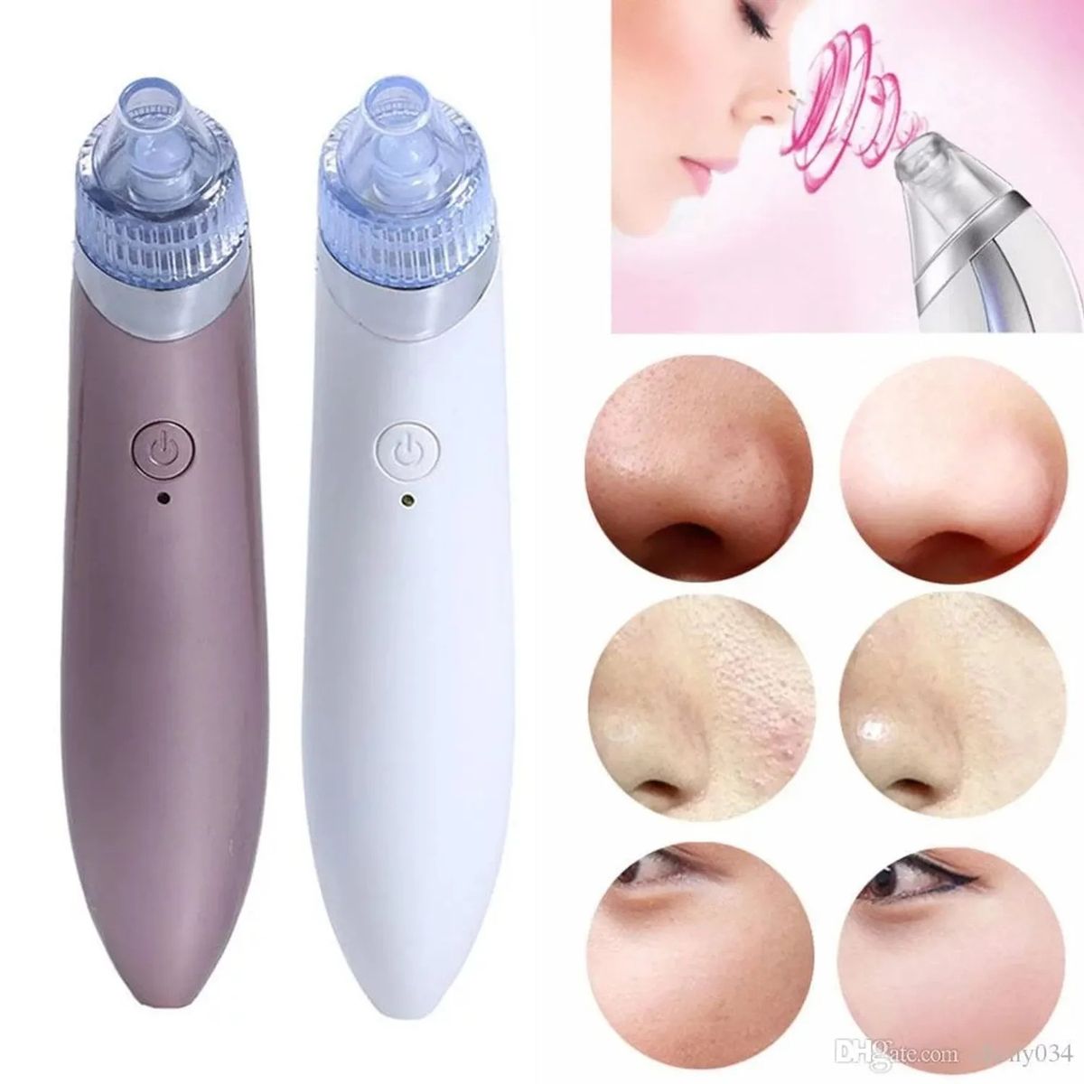 MOVI - Extractor y removedor de Puntos Negros