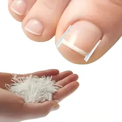 GENERICO - Corrector de Uñas Encarnadas 50 Piezas Plástico Blanco