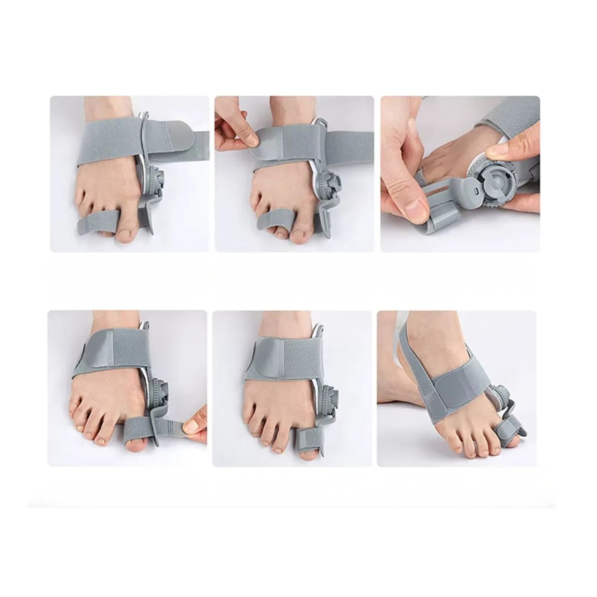 GENERICO - Corrector de Juanetes Ajustable FeetiFix con Bisagra Giratoria de 45° - Alivio y Enderezamiento