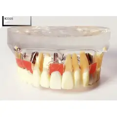 GENERICO - Modelo de implante dental parte superior M2005