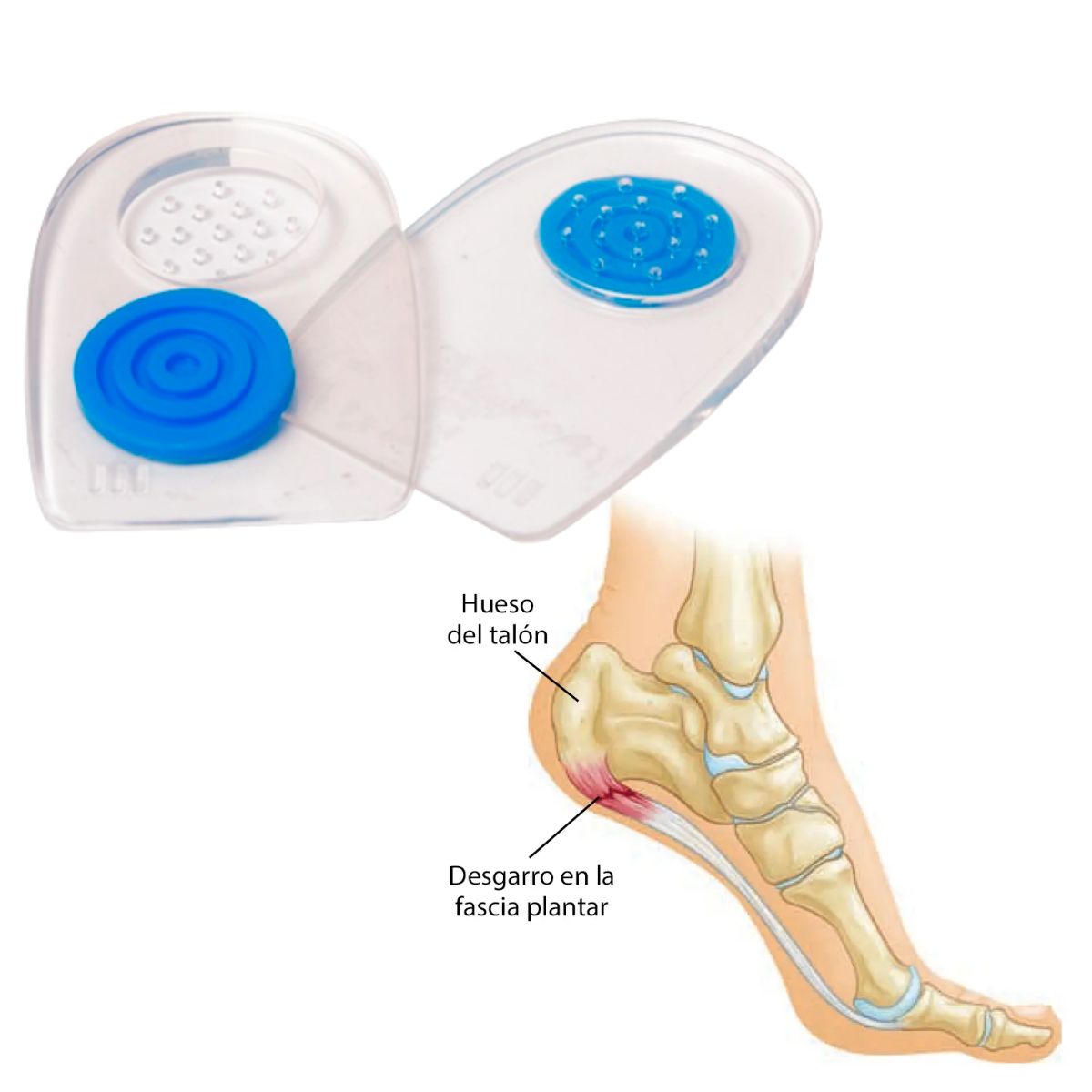 GENERICO - Par Talonera Para Espolón Con Punto Extraíble Deroyal