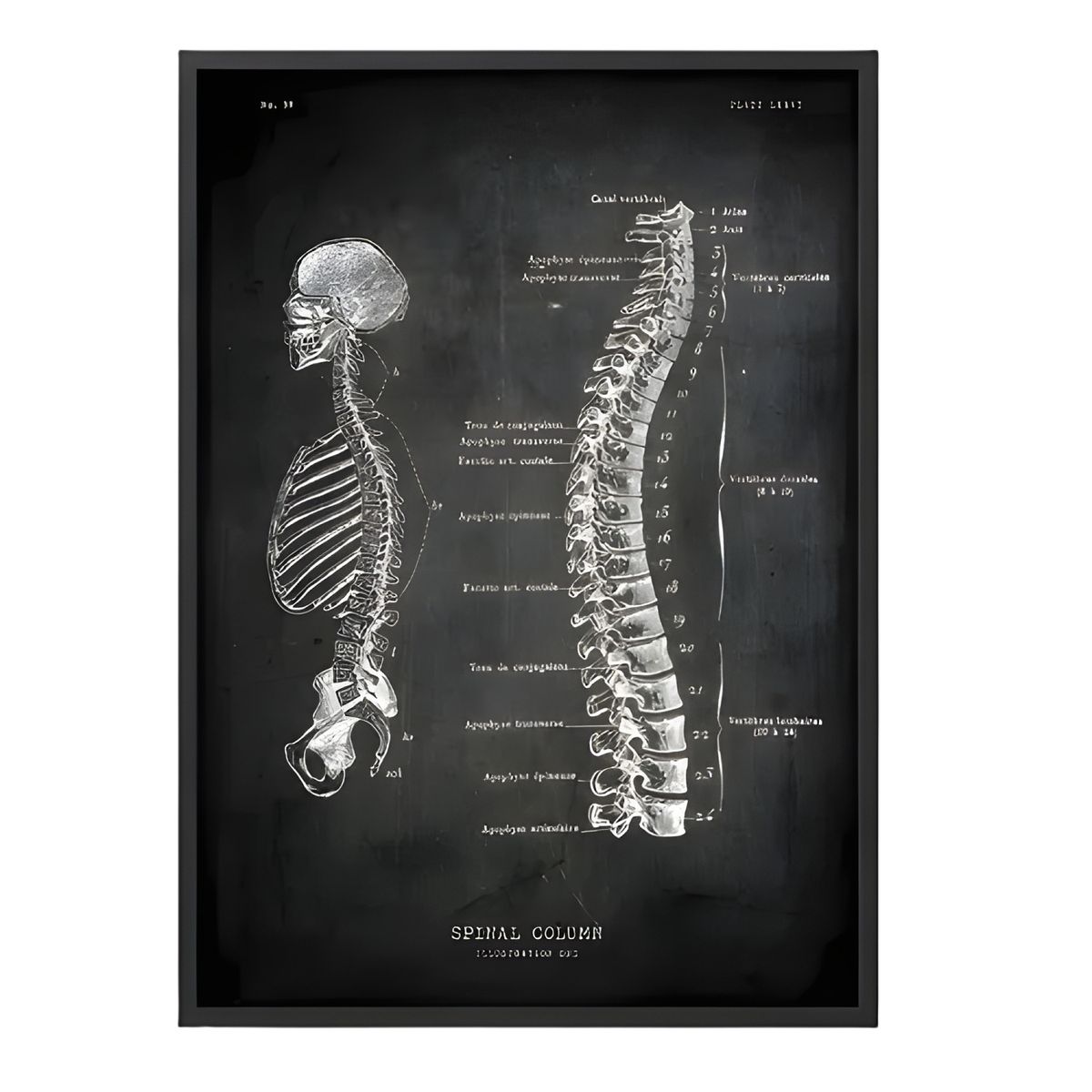 GENERICO - Cuadro póster columna vertebral 40x50 Negro
