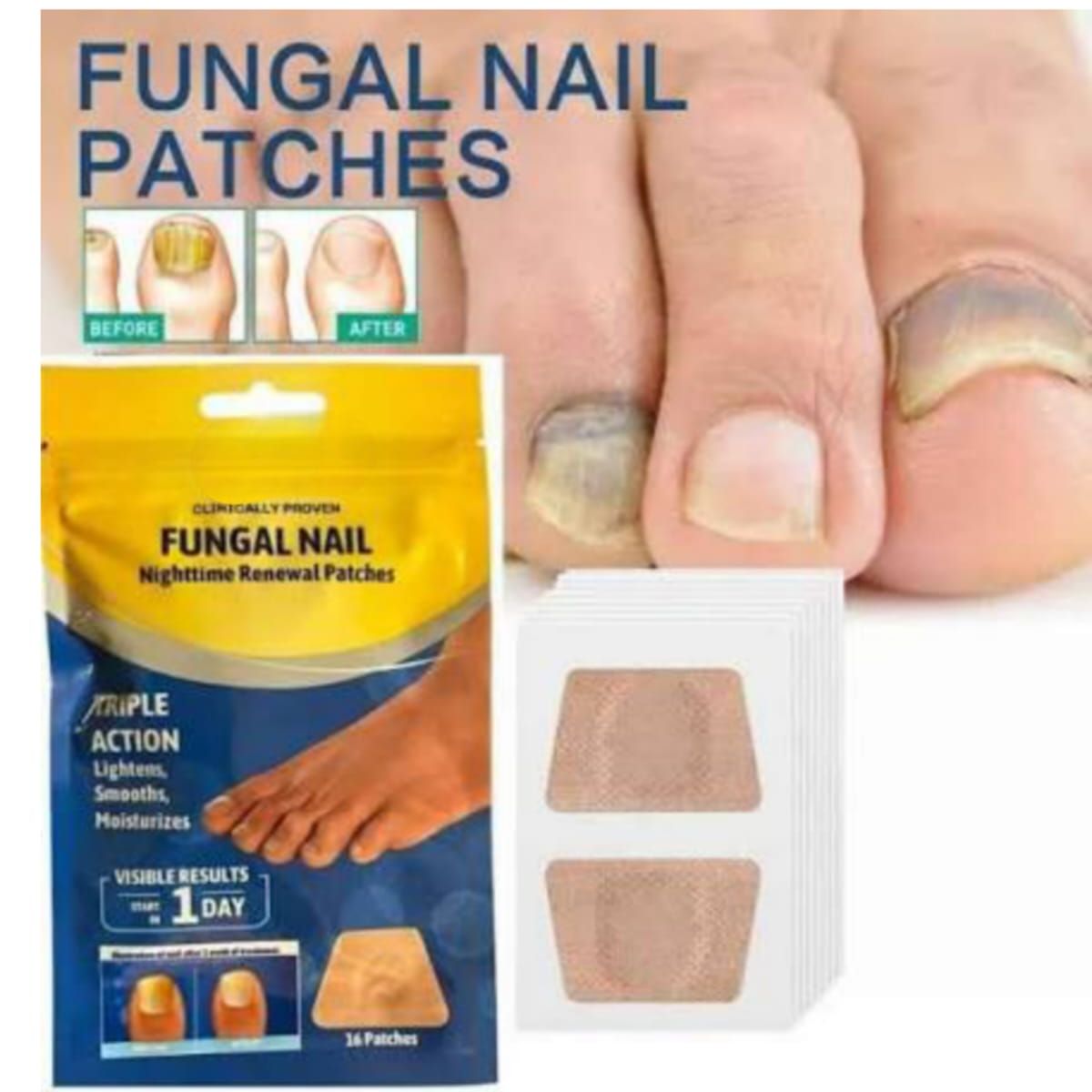 GENERICO - 16  Parches Antihongos Uñas Parches Hongos Uñas Pies Tamaño Grande