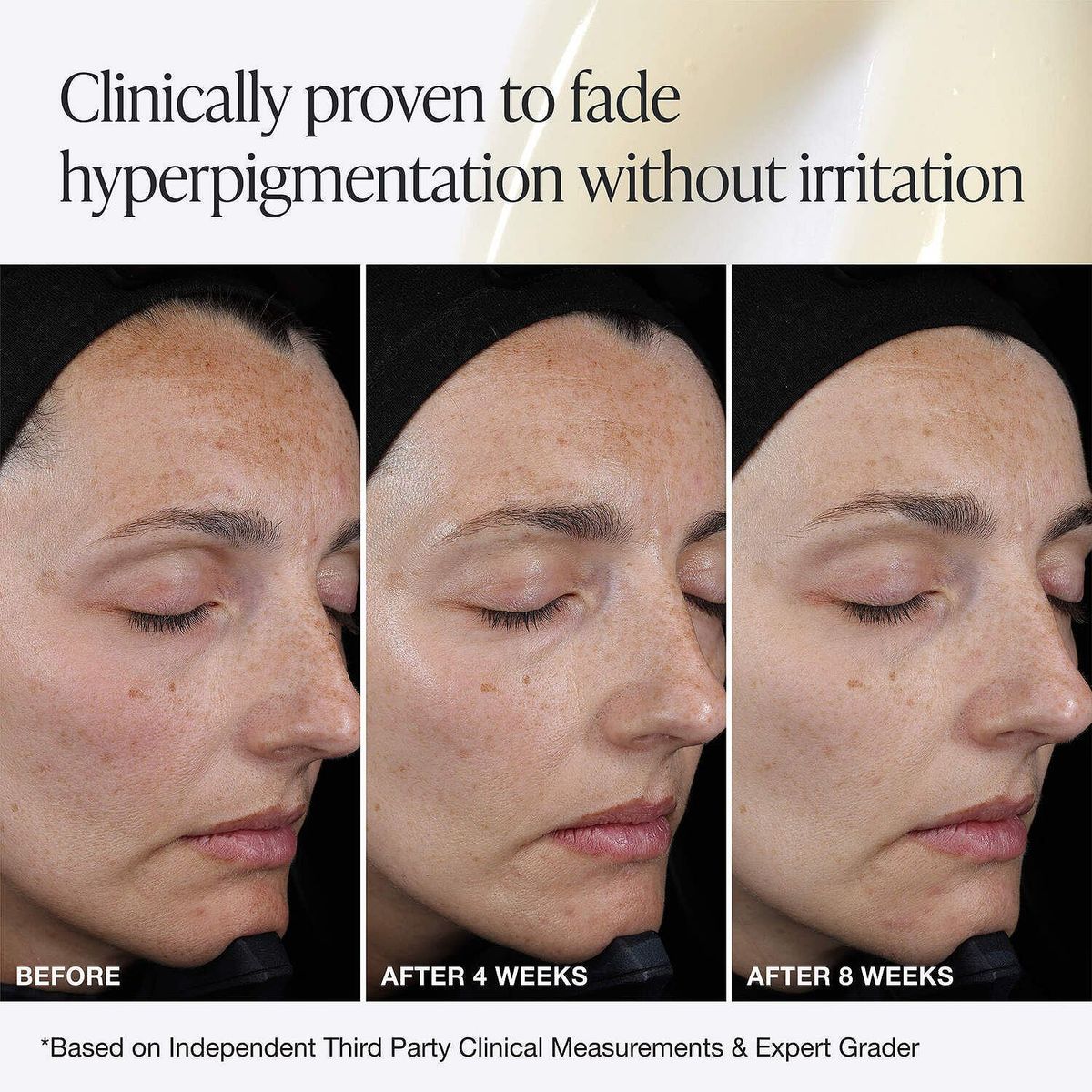 INNBEAUTY - Serum Iluminador Pro C con 15% Vitamina C + Acido Ferulico - Innbeauty Project