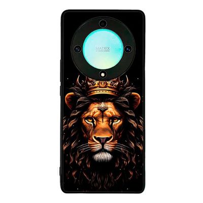 Carcasia Carcasa Compatible Con Honor Magic 8 Lite Diseño