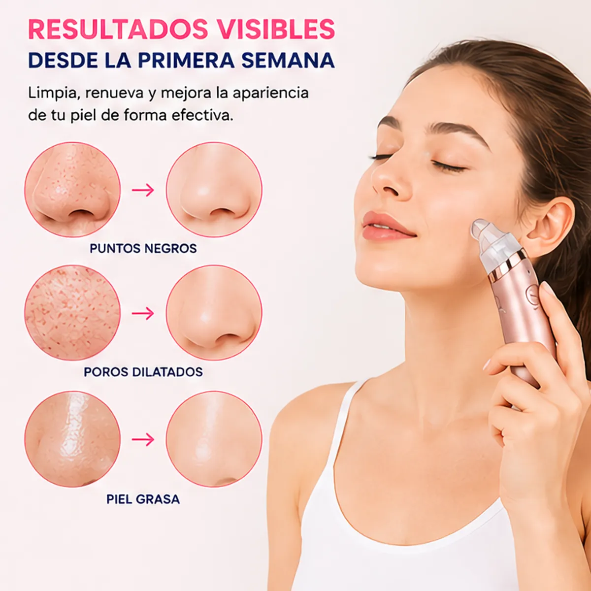 GENERICO - Removedor Extractor de Puntos Negros e Impurezas Facial USB