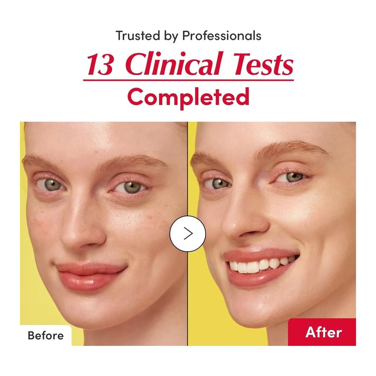 GENERICO - Eqqualberry Vitamin Illuminating Serum Iluminador Facial