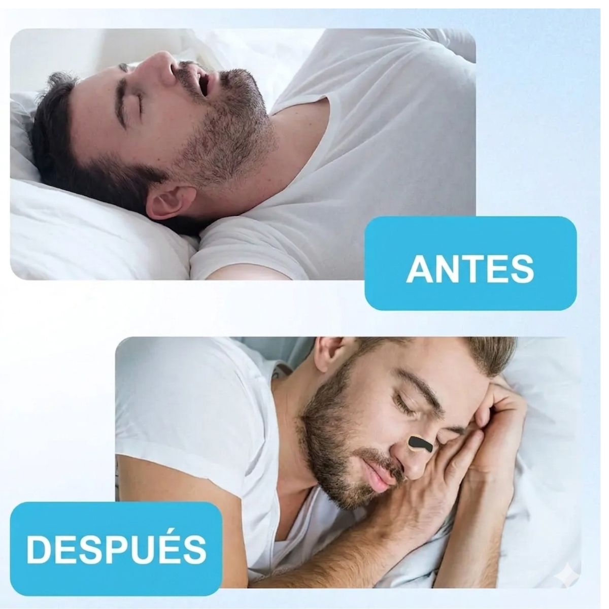 GENERICO - Dilatador Nasal Anti Ronquidos Kit De Inicio 15 Días