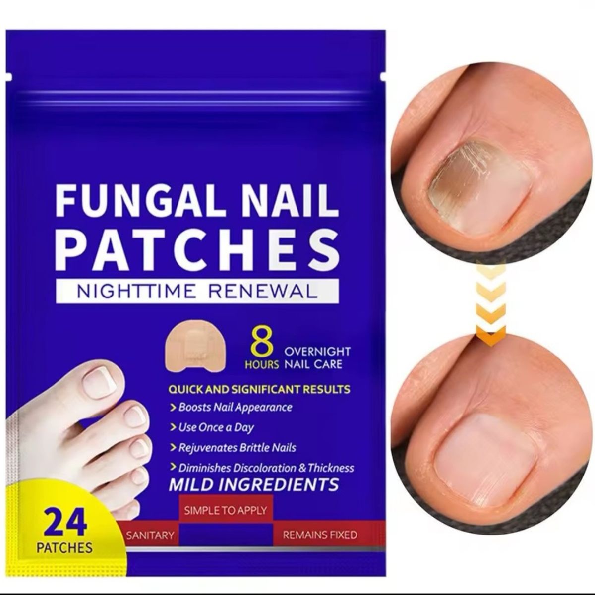 GENERICO - Parche Antibacteriano Hongos Uñas Onicomicosis 24 Unidades