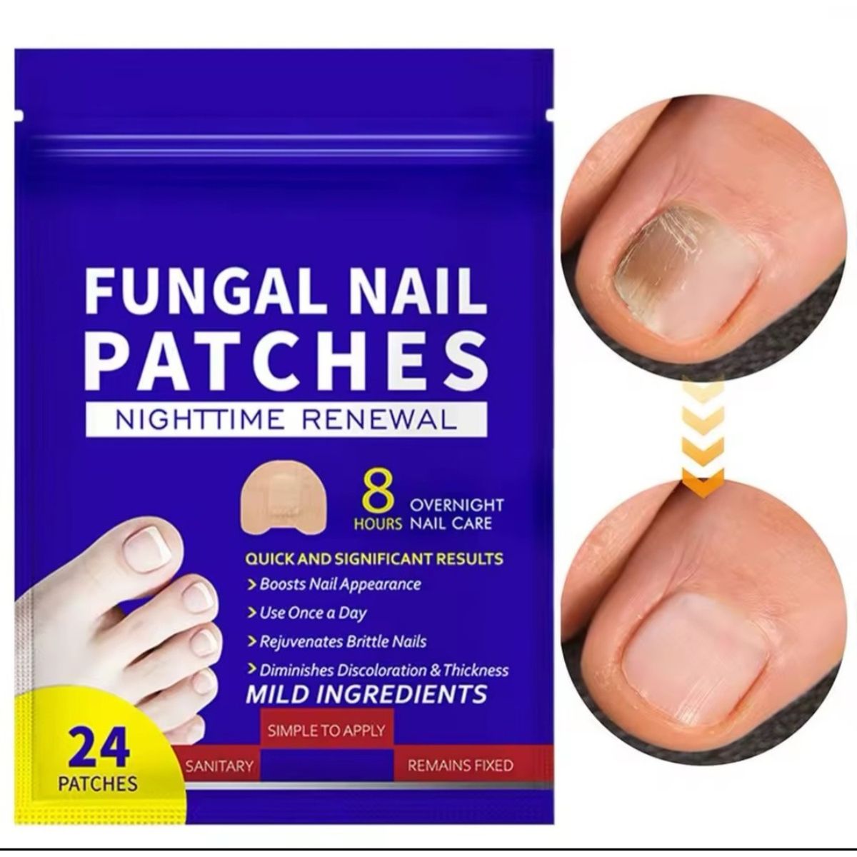 GENERICO - Parche Antibacteriano Hongos Uñas Onicomicosis 24 Unidades