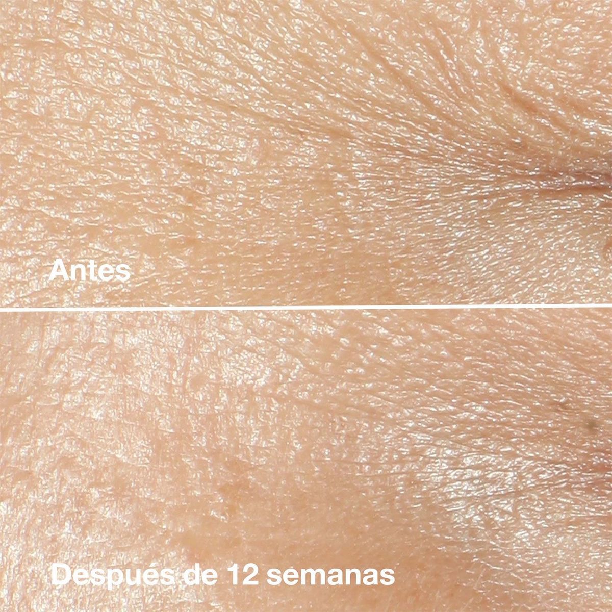 CLINIQUE - Crema Antiarrugas Smart Clinical Repair Antiedad 50 Ml Clinique