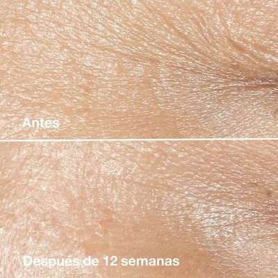 Imagen 2 del producto Crema Antiarrugas Smart Clinical Repair Antiedad 50 Ml