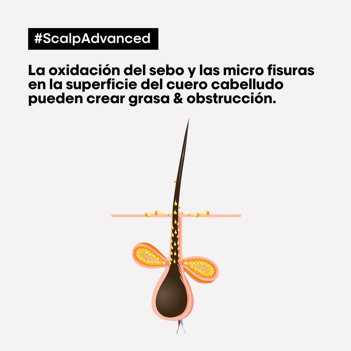 LOREAL PROFESSIONNEL - Shampoo Limpieza Profunda Cabello Graso Scalp Advanced 300ml  Loreal Professionnel