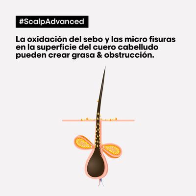 Imagen 2 del producto Tratamiento Capilar Máscara 2 en 1 Limpieza Profunda Cabello Graso Scalp Advanced 250 ml