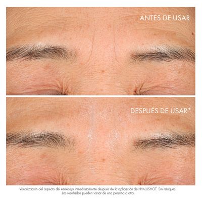 Imagen 2 del producto Corrector De Arrugas Hyalushot 15Ml Dior