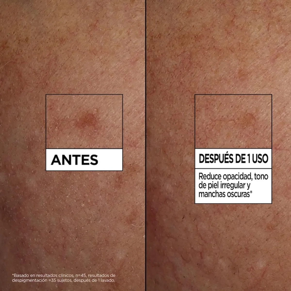 GARNIER - Sérum Limpiador 100 ML Garnier