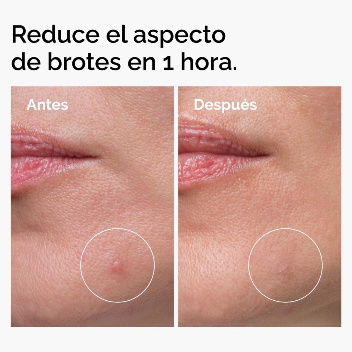 THE ORDINARY - Concentrado para Acne y Control de Sebo - 10% Azufre - The Ordinary 5g