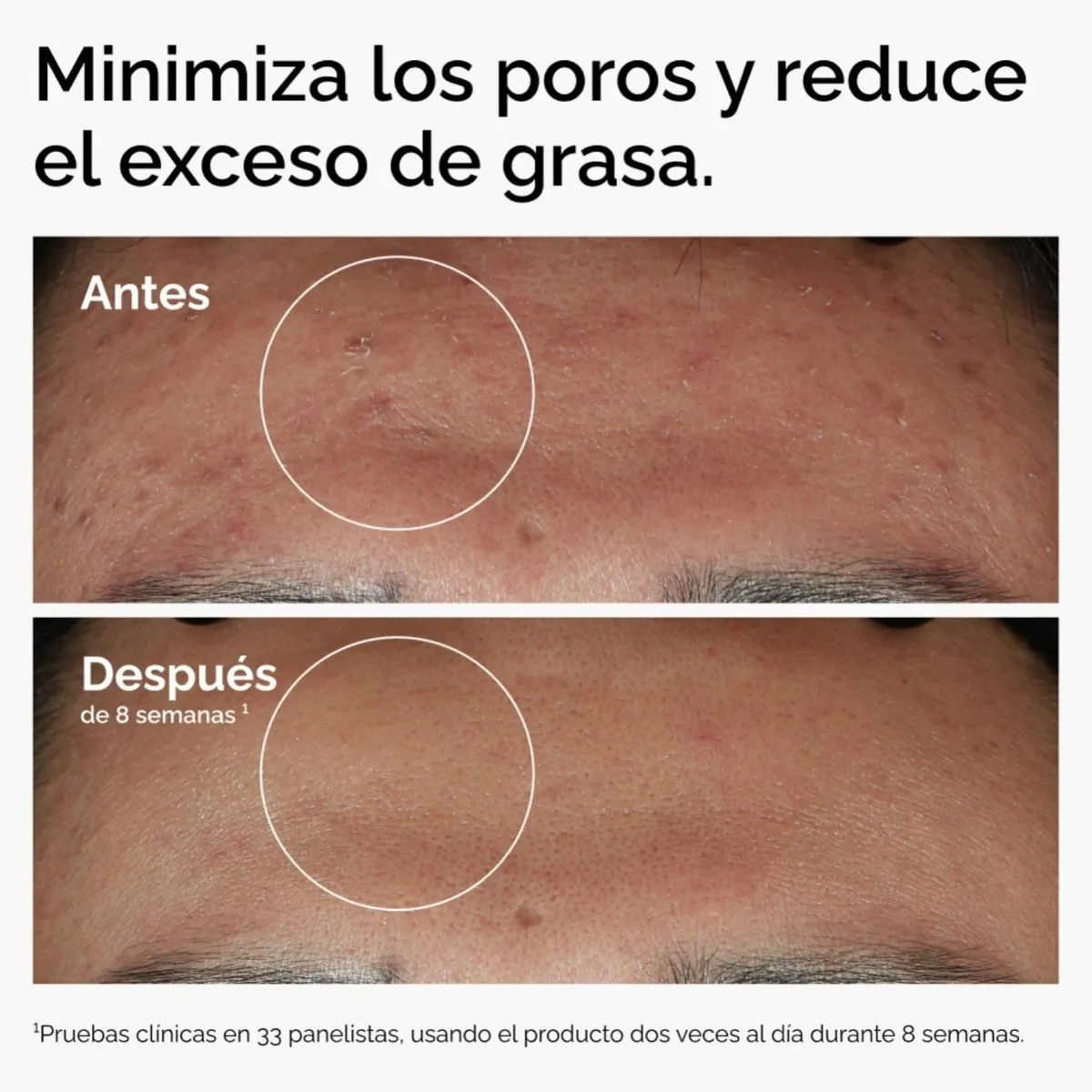 THE ORDINARY - Serum Niacinamida 10% + Zinc 1% - The Ordinary 60 ml