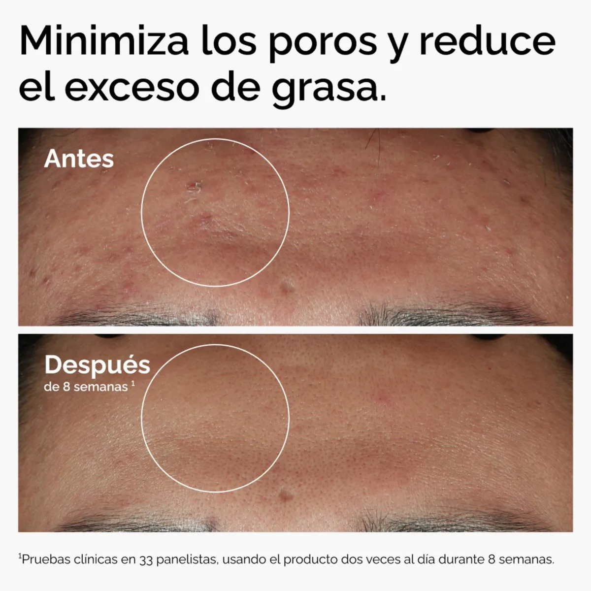 THE ORDINARY - Serum Niacinamida 10% + Zinc 1% - The Ordinary 30 ml