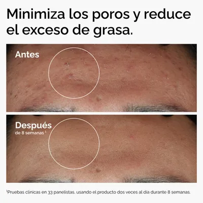 Imagen 2 del producto Serum Niacinamida 10% + Zinc 1% - 30 ml