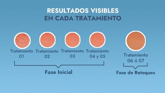 ¡Los resultados se notan!