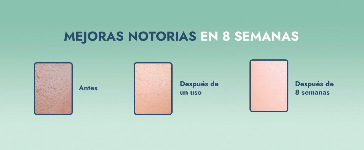 Cepillo de limpieza facial sónico con calor Verde Vesper