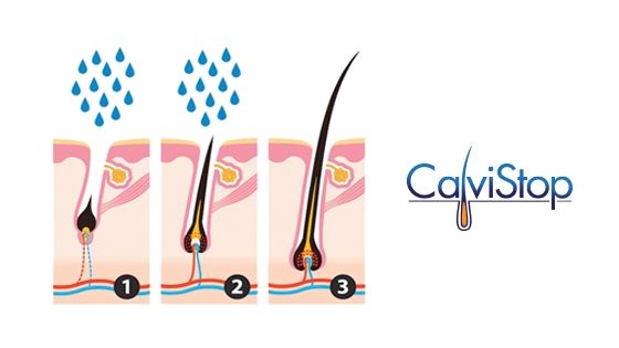 <p>Calvistop Anticaída</p>