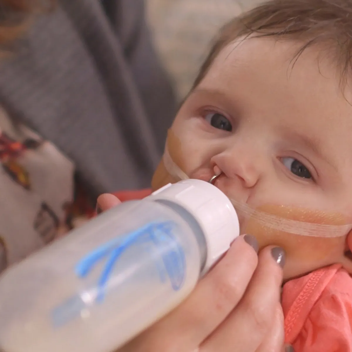 DR BROWNS - Teteros Dr Brown Alimentacion Especial Labio Leporino 250 ml