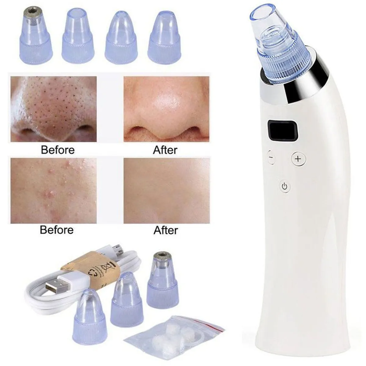 GENERICO - Removedor Extractor Puntos Negros Espinillas Poros Digital Recargable