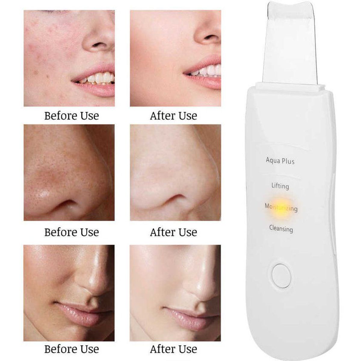 ZHOPI CO - Limpiador UltrasÃ³nico Facial De Iones Tipo EspÃ¡tula Con VibraciÃ³n