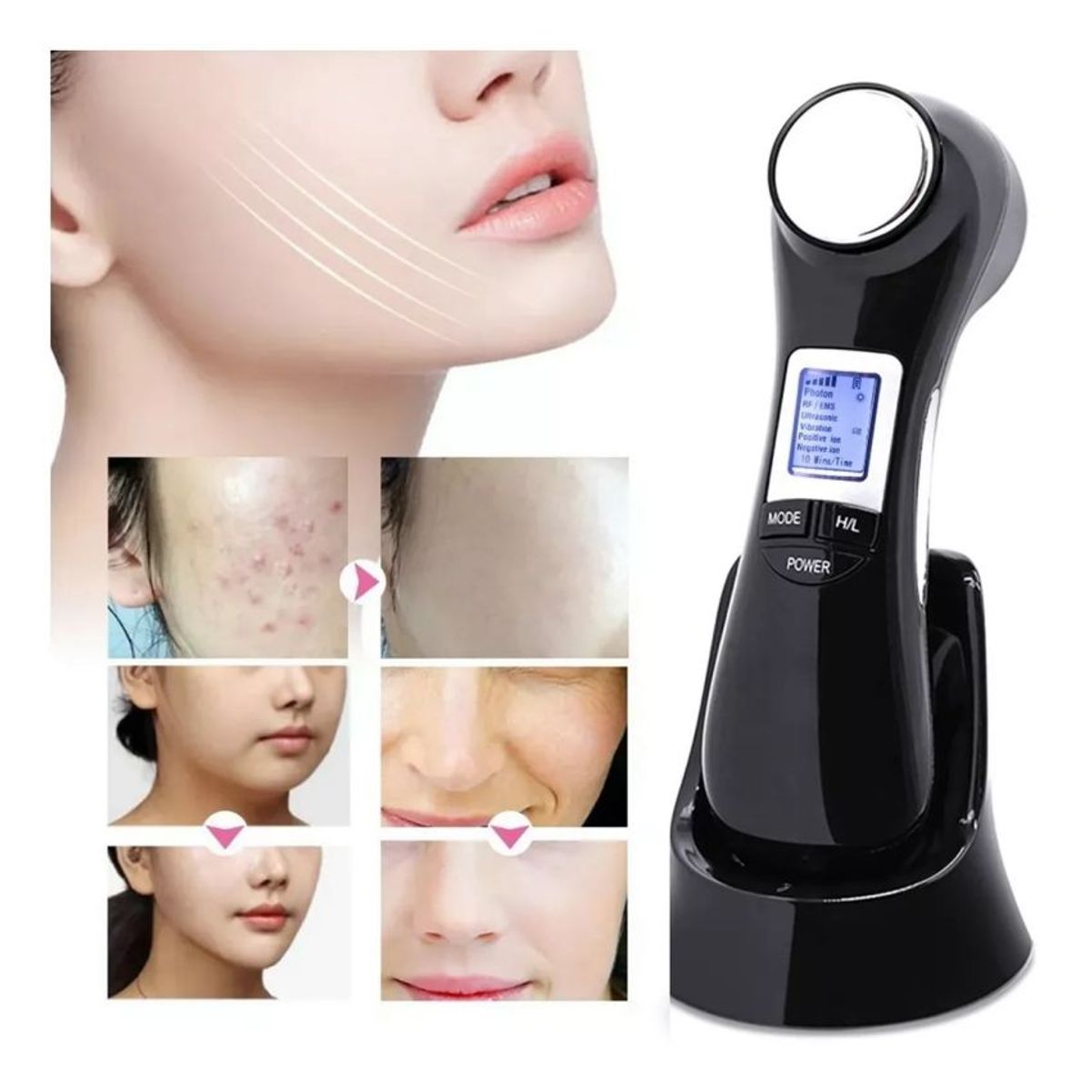 CARER SPARK - Ultrasonidos Radiofrecuencia Masajeador Facial y Corporal 6 en 1 Fotón