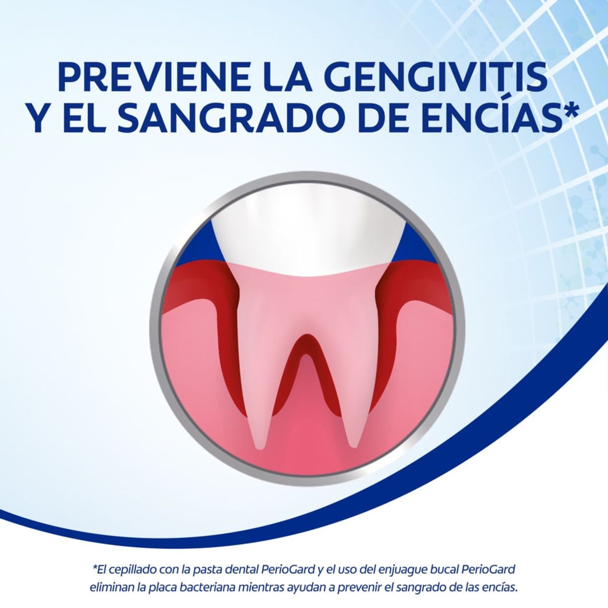 COLGATE - Enjuague Bucal Colgate Periogard Sin Alcohol X 250ml