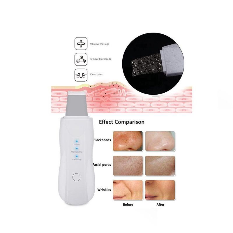 GENERAL - Extractor Facial De Espinillas Y Puntos Negros 3 Niveles Vibracion.