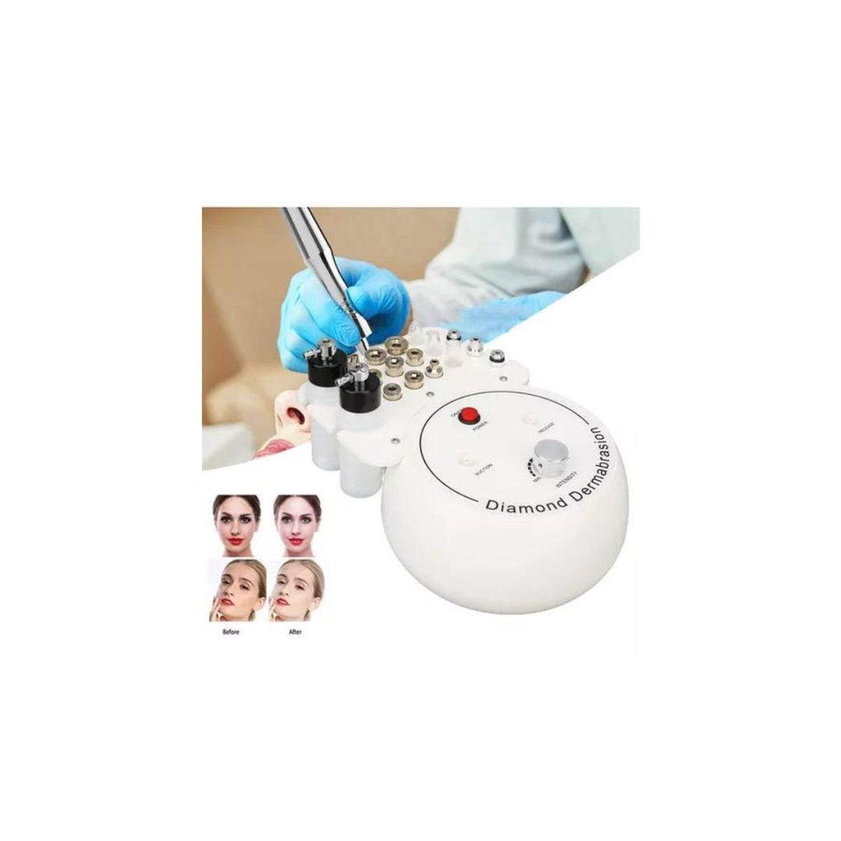 GENERICO - Máquina De Dermoabrasión Microdermoabrasión 3 En 1