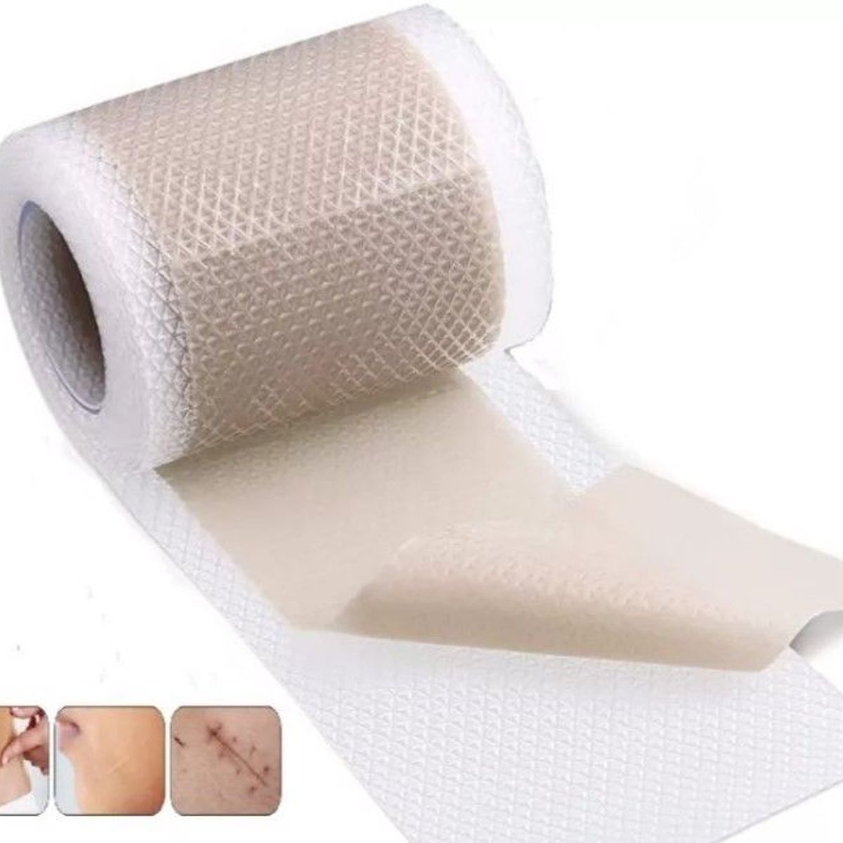 GENERICO - Cinta Parche De Silicona para cicatrices