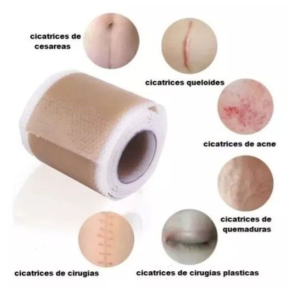 GENERICO - Cinta Parche De Silicona para cicatrices
