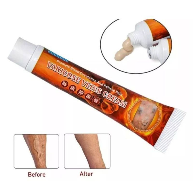 GENERICO - Crema Herbal Venas Varices Flebitis