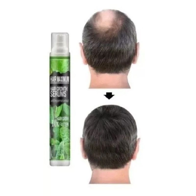 GENERICO - Tónico Herbal para el Crecer Cabello anticalvicie